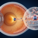CFH risk variant linked to complement changes in non-AMD eyes