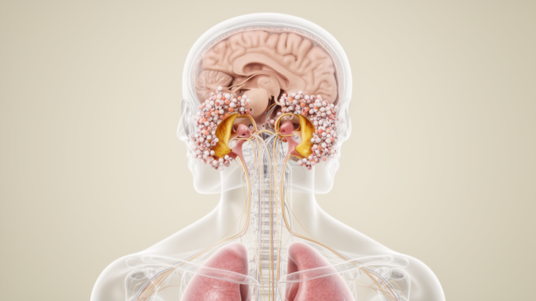 Case report links lung cancer leptomeningeal metastasis to bilateral vestibulopathy