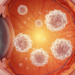 Genetically elevated eosinophil counts linked to AMD in European cohorts