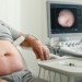 Diagnostic triage for ultrasound-detected subclinical insulin injection–related lipohypertrophy in older adults with diabetes: development and internal validation