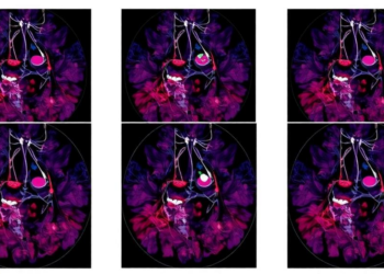 Tumor Diversity Emerges as a Hidden Driver of Chemotherapy Failure in Breast Cancer