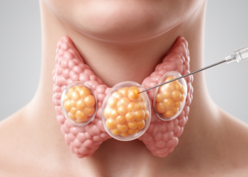 Follicular thyroid tumors expose a diagnostic gap in minimally invasive procedures