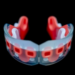 Mouthguard Sensors Reveal Which Rugby Moments Shake the Brain Hardest