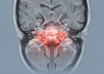 Pooled case reports reveal often MRI-silent nivolumab pituitary toxicity