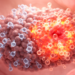 Immune and proliferative programs distinguish anti-PD-1-responsive endometrial cancer
