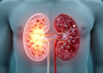Kidney transplant electrolyte disorders do not track NCC activation