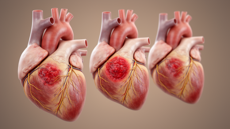 Ventricular injury timelines may not fit the heart’s conduction system