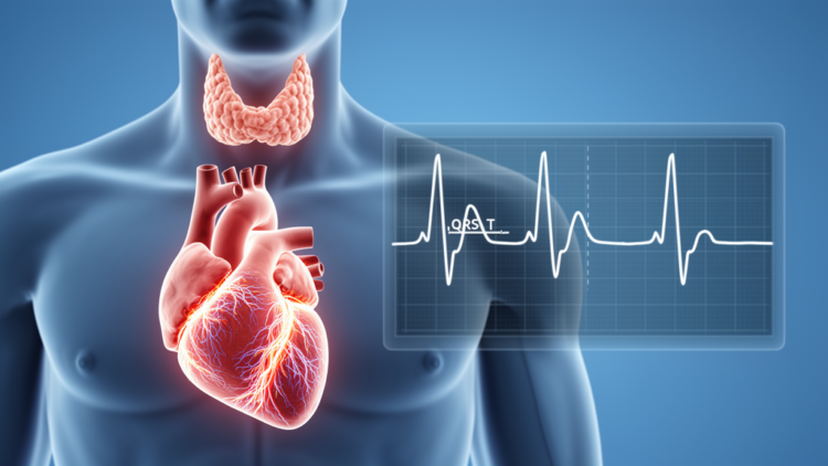 Graves’ hyperthyroidism linked to wider ventricular QRS-T angle