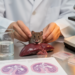 Gudan Wan reduced liver injury in mouse model of MASH