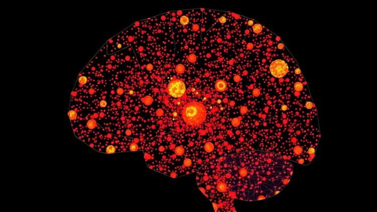 Massive Single-Cell Map of Childhood Brain Tumor Reveals Immune Signal That Predicts Survival