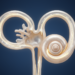 Rare Inner Ear Disorder May Have Struck All Three Balance Canals at Once