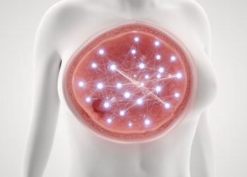 Survey links digital engagement to breast cancer registry interest