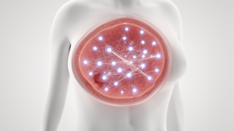 Survey links digital engagement to breast cancer registry interest