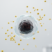 Cysteine Dependence Reveals Metabolic Weakness in Small Cell Lung Cancer