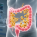 Anaemia and antifungal exposure flag Candida auris gut carriage in ICU