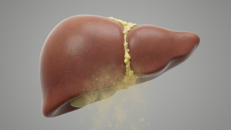 Experimental drug rejuvenates aged rat livers, halving amyloid beta and LDL