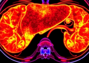 Liver Imaging System LI-RADS Emerges as a Powerful Prognostic Biomarker in Liver Cancer