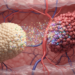 Diabetes and pancreatic cancer reveal a two-way molecular warning system