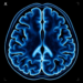 CT Scans Reveal First Brain Ventricular Norms for Healthy Bangladeshi Adults