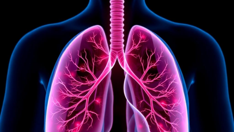 Lung Cancer Immunotherapy Triggers Life-Threatening Multi-System Immune Reactions in One Patient