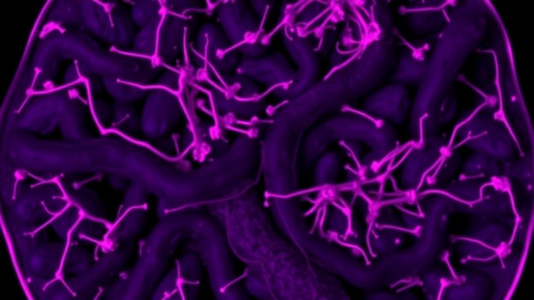 Osteopontin Fingerprints in Tissue Scans Predict Pancreatic Cancer Survival