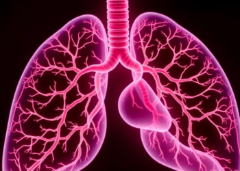 Immunotherapy Brings Three-Year Survival in Rare, Usually Fatal Lung Vascular Cancer Syndrome