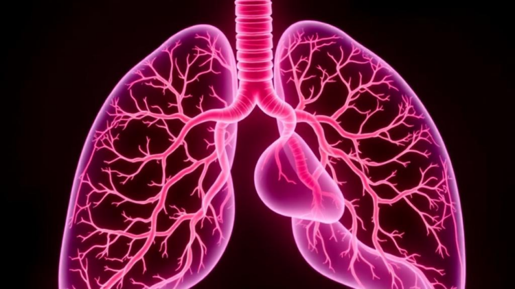 Immunotherapy Brings Three-Year Survival in Rare, Usually Fatal Lung Vascular Cancer Syndrome