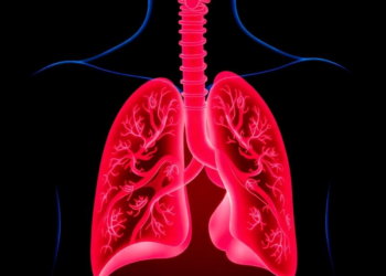 Quantitative PCR Outperforms Microscopy in Turkish Study of Pneumocystis Pneumonia