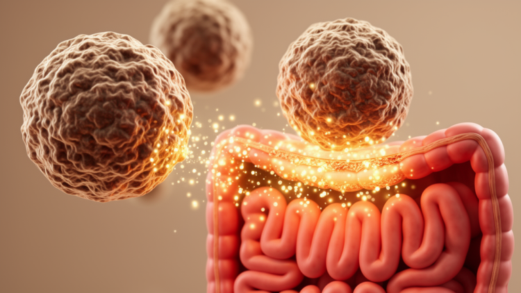 Engineered IL-10-Secreting Macrophages Ease Colitis Symptoms in Mice
