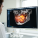 AI reshapes oral cancer diagnosis from clinical imaging to precision therapy