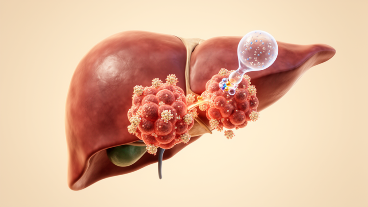 Checkpoint inhibitors improve survival in pMMR metastatic colorectal cancer meta-analysis