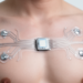 Printed liquid-metal electrodes track motion and heart signals