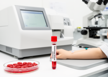 RDW only blood marker linked to paediatric brucellosis in small retrospective study