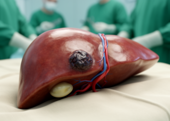 Rare Liver Vascular Tumour Reported for the First Time in a Transplant Graft