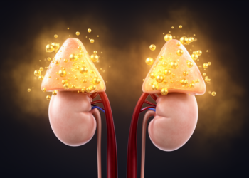 Mild by Name Only: The Hidden Burden of Subtle Cortisol Excess