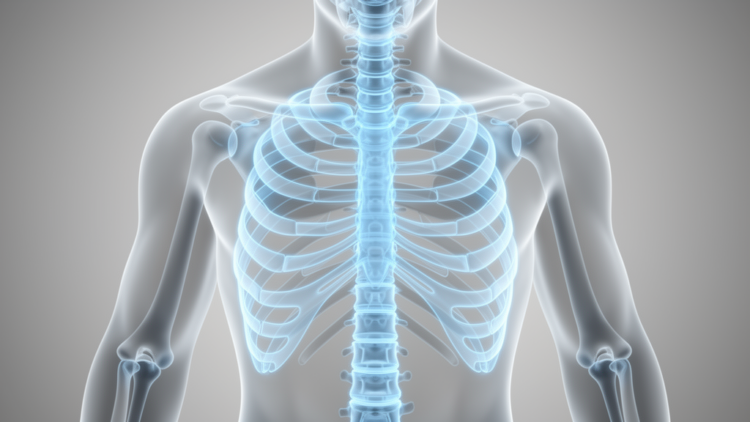 Modeling Shows AI Chest X-Ray Osteoporosis Screening Cost-Effective