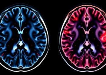 AI Reads MRI Scans to Reveal Hidden Survival Clue in Liver Metastases