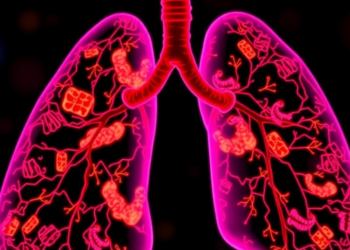 Lysosome Gene Signature Offers New Prognostic Tool for Lung Cancer
