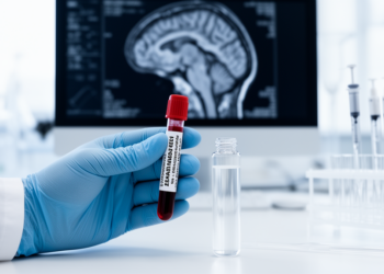Blood RNA patterns track essential tremor brain and cognitive differences