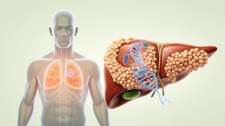 Genetic and metabolic risks linked to early cirrhosis in adults with MASLD