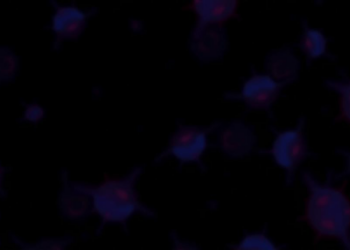 Silent Receptor Boost: Non-Signaling CARs Supercharge T-Cells Against Head and Neck Cancer