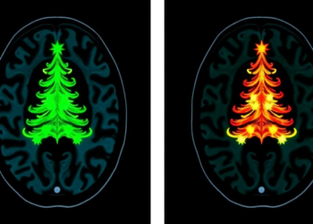 Rare Fungal Brain Infection Reveals Striking Christmas-Tree Sign on MRI