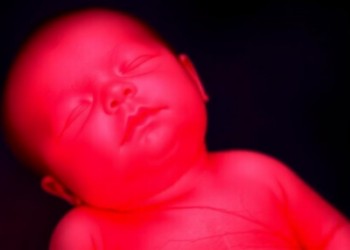 European Experts Issue First Standardized Rules for Tiny Arterial Lines in Newborns