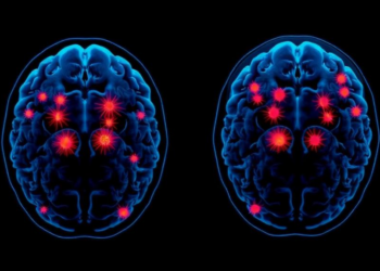 Immune Cell Clusters Inside Brain Tumors Predict Glioblastoma Survival
