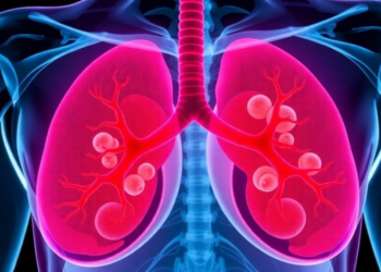 Breast Cancer History Emerges as Striking Signal in Gallbladder Cancer Patients