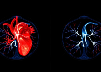 Heart Scan Warning: Low Flow Reserve on PET Quadruples Risk of Death and Heart Failure