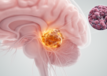 Rare Brain Tumor Puzzle: Fetal-Type Cancer in the Cerebellopontine Angle With No Lung Primary Found