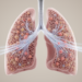 Sixty Years After ARDS Was Named, Scientists Ask Whether Ventilation Can Help Lungs Repair