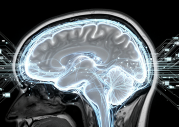 Attention-Guided Distillation Boost Alzheimer’s Stage Identification Using MRI Scans