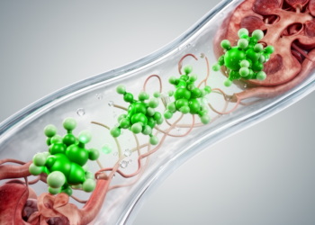 Urinary Succinate Emerges as Potential Non-Invasive Biomarker for Diabetic Kidney Disease
